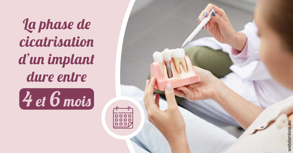 https://www.dr-dorothee-louis-olszewski-chirurgiens-dentistes.fr/Cicatrisation implant 2