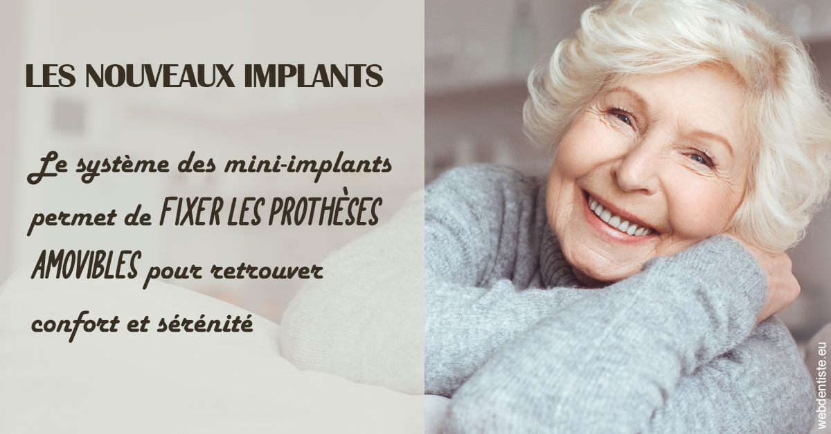 https://www.dr-dorothee-louis-olszewski-chirurgiens-dentistes.fr/Les nouveaux implants 1