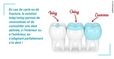 https://www.dr-dorothee-louis-olszewski-chirurgiens-dentistes.fr/L'INLAY ou l'ONLAY