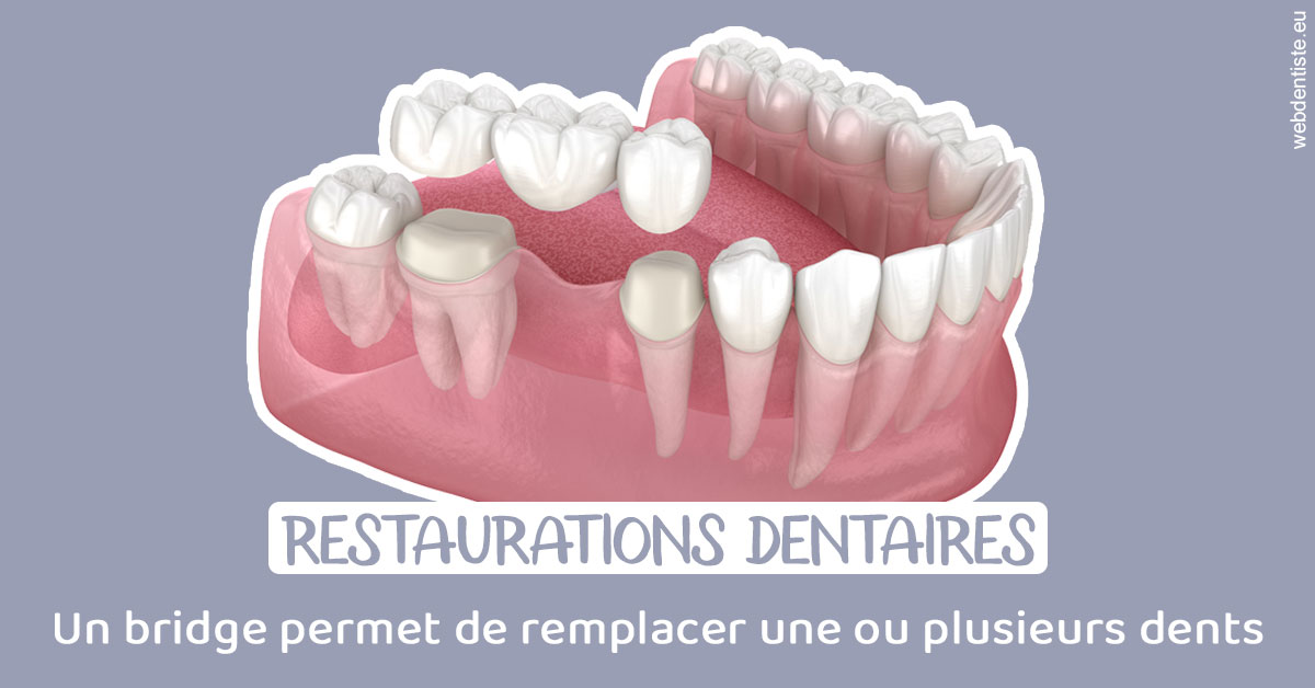 https://www.dr-dorothee-louis-olszewski-chirurgiens-dentistes.fr/Bridge remplacer dents 1