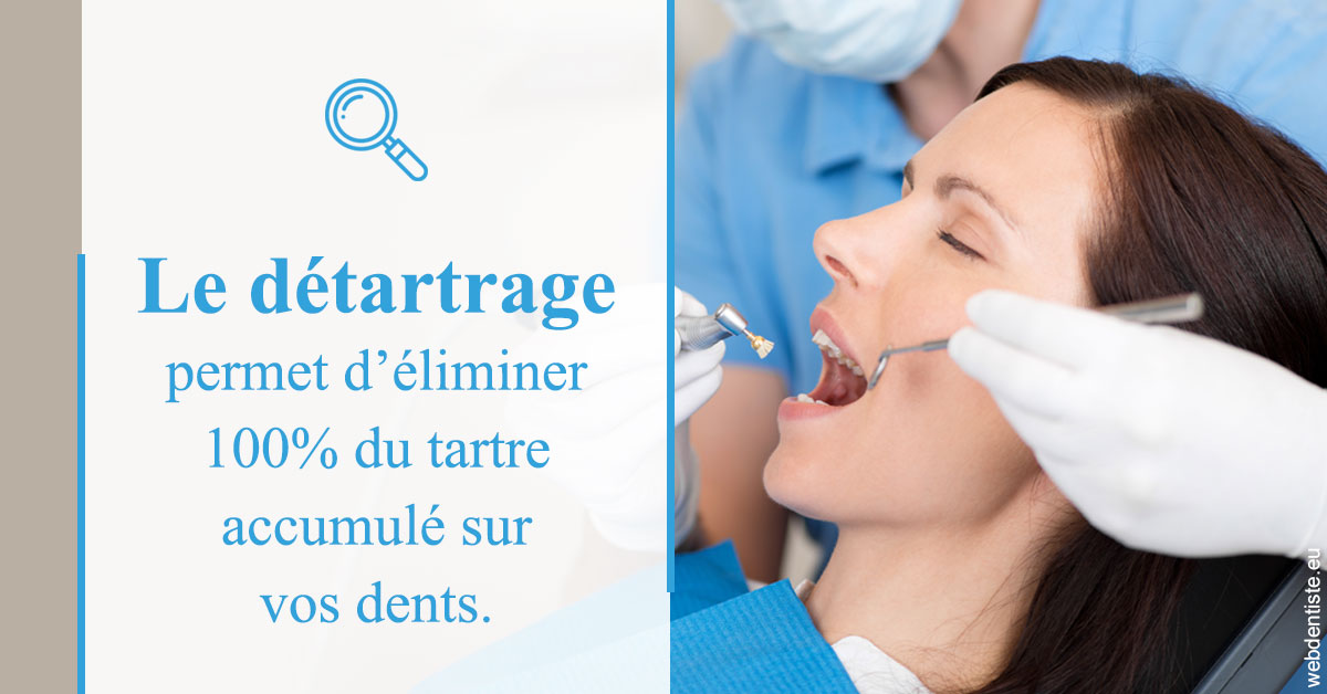 https://www.dr-dorothee-louis-olszewski-chirurgiens-dentistes.fr/En quoi consiste le détartrage