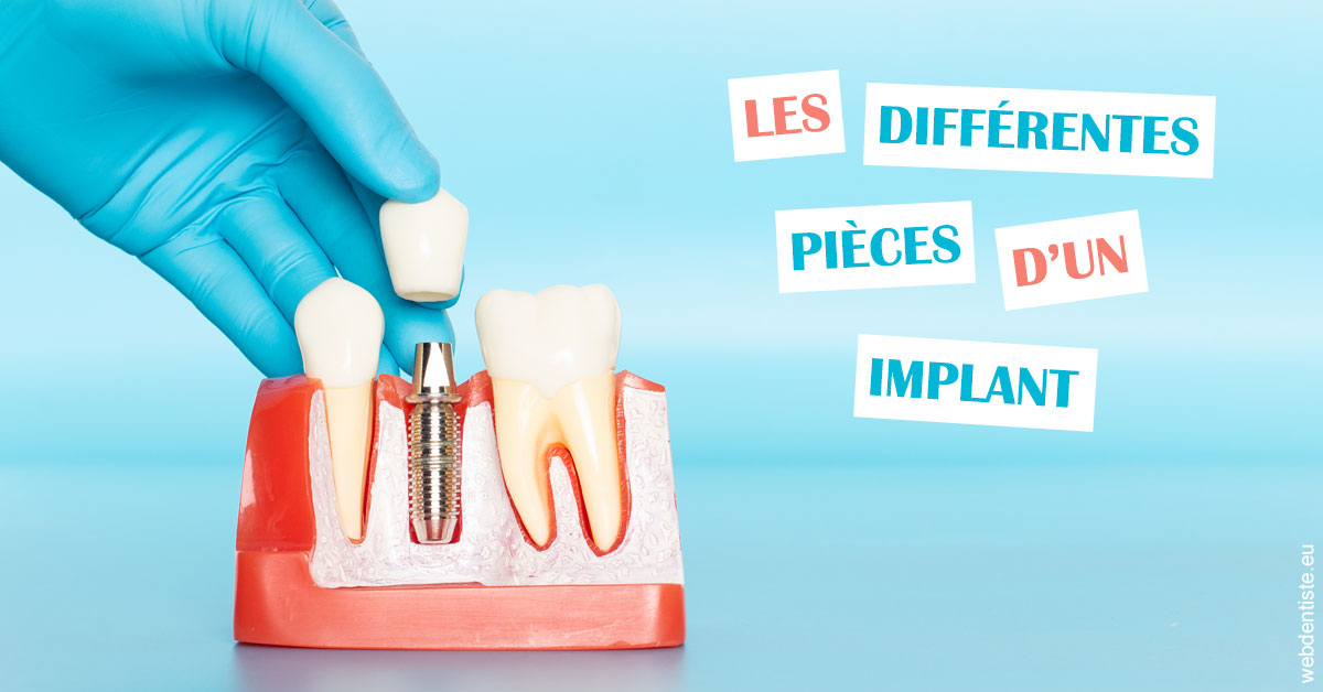 https://www.dr-dorothee-louis-olszewski-chirurgiens-dentistes.fr/Les différentes pièces d’un implant 2