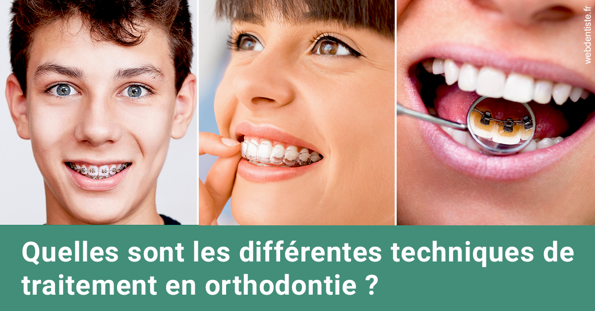 https://www.dr-dorothee-louis-olszewski-chirurgiens-dentistes.fr/Les différentes techniques de traitement 2