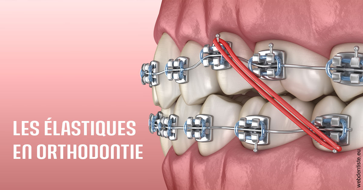 https://www.dr-dorothee-louis-olszewski-chirurgiens-dentistes.fr/Elastiques orthodontie 2