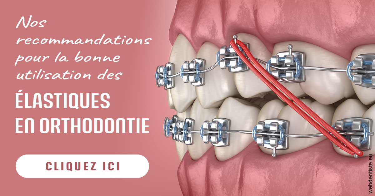 https://www.dr-dorothee-louis-olszewski-chirurgiens-dentistes.fr/Elastiques orthodontie 2