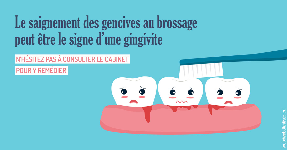 https://www.dr-dorothee-louis-olszewski-chirurgiens-dentistes.fr/2023 T4 - Saignement des gencives 02