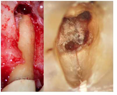 Le-microscope-opératoire-en-Endodontie-3 (1)